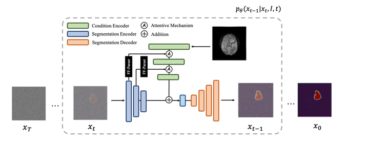MedSegDiff: Medical Image Segmentation with Diffusion Probabilistic ...