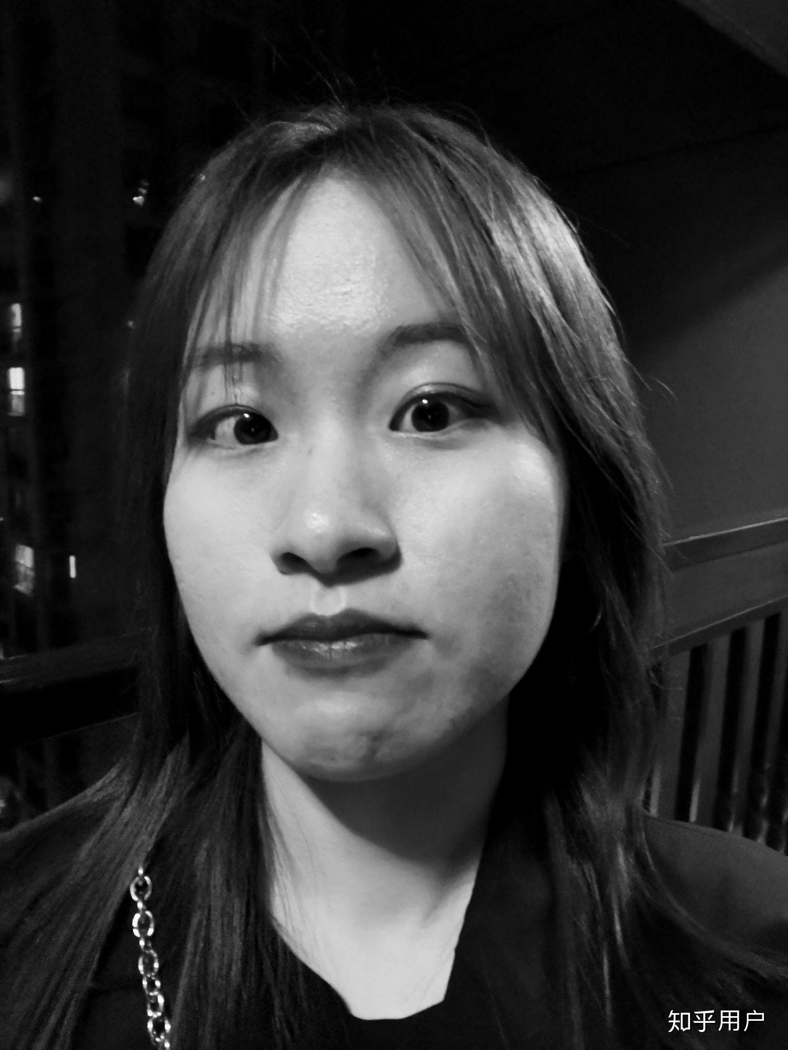 得了抑郁症的人眼神是不是都是一样的