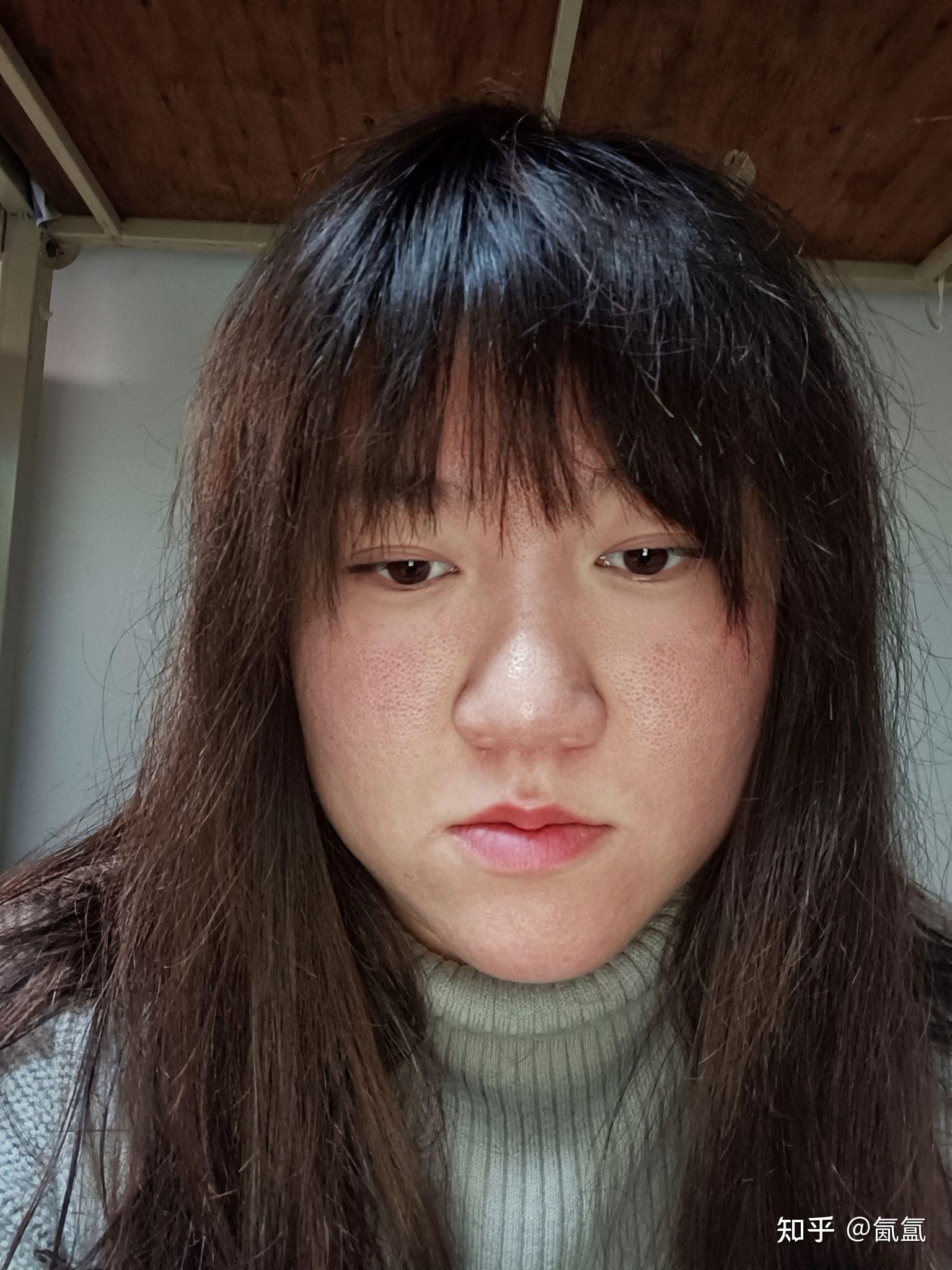 为什么女生会爆照