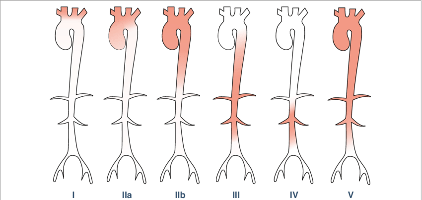 大动脉炎有这么吓人吗