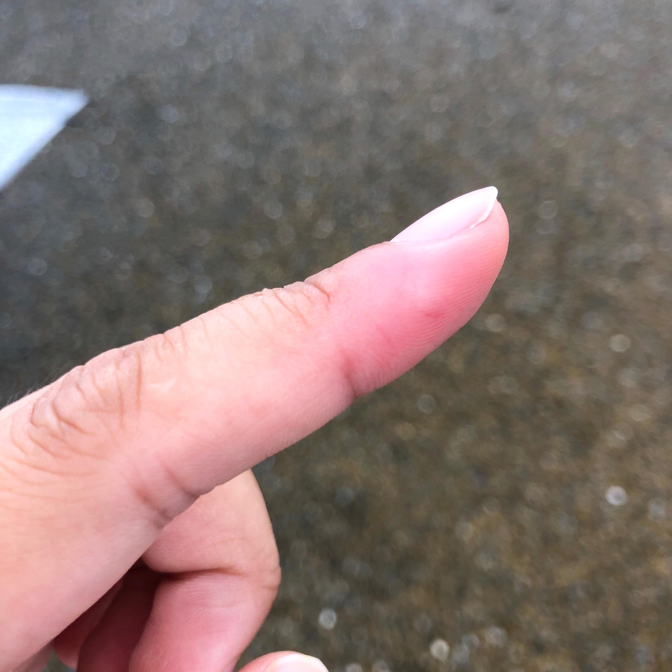 被螃蟹夹到手是一种怎样的体验