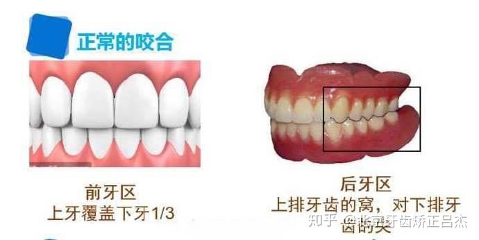 正常牙齿咬合是怎样的