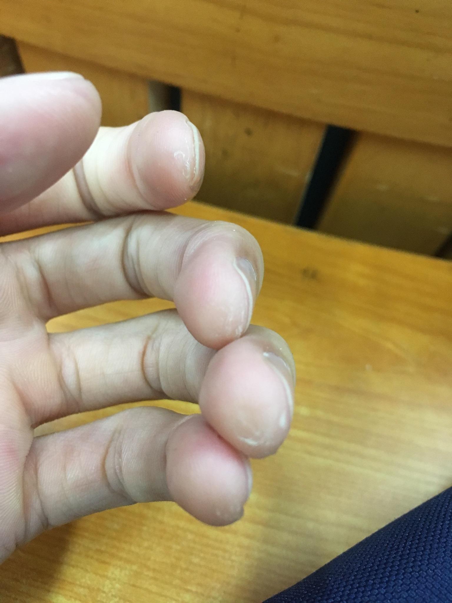 玩吉他的朋友可以拍一张左手手指上的茧吗? - 知乎