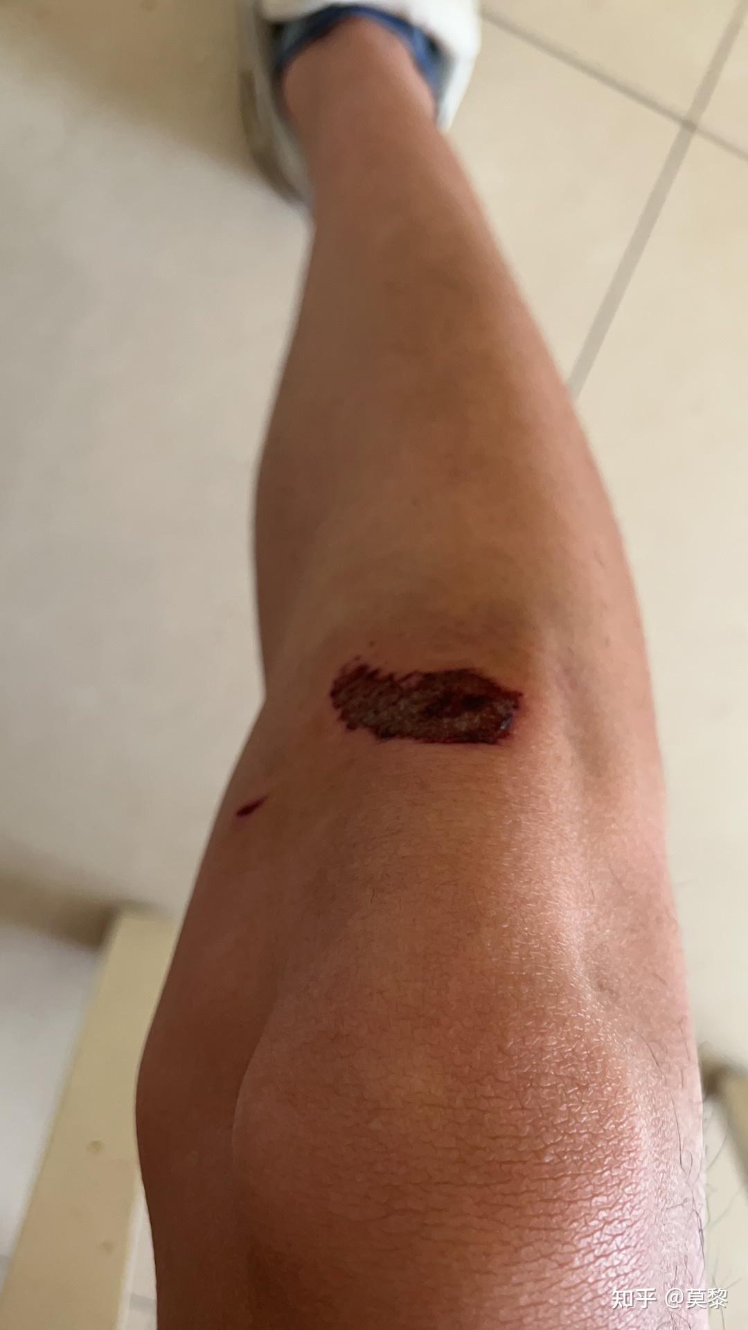 骑自行车时穿锁鞋,那摔车了脚拿不下来岂不是很危险? - 知乎