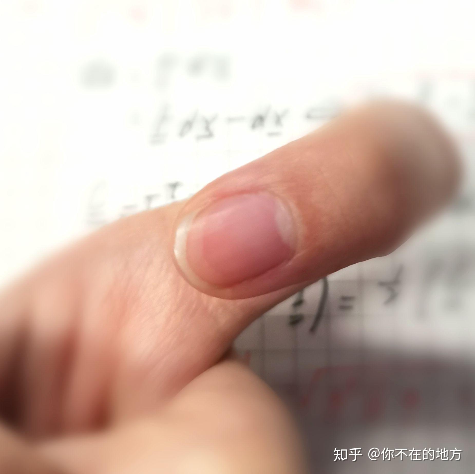 如何可以让手指甲的游离线向指尖提前一点? - 知乎
