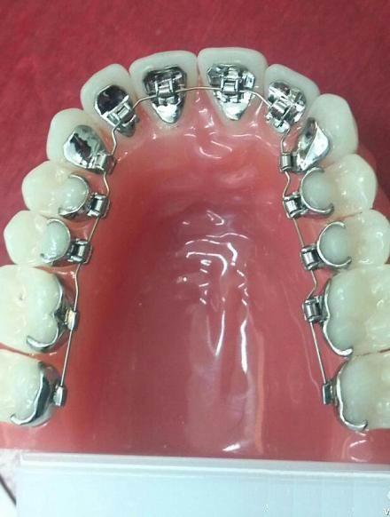 郑州能做舌侧矫正的医生有谁啊?