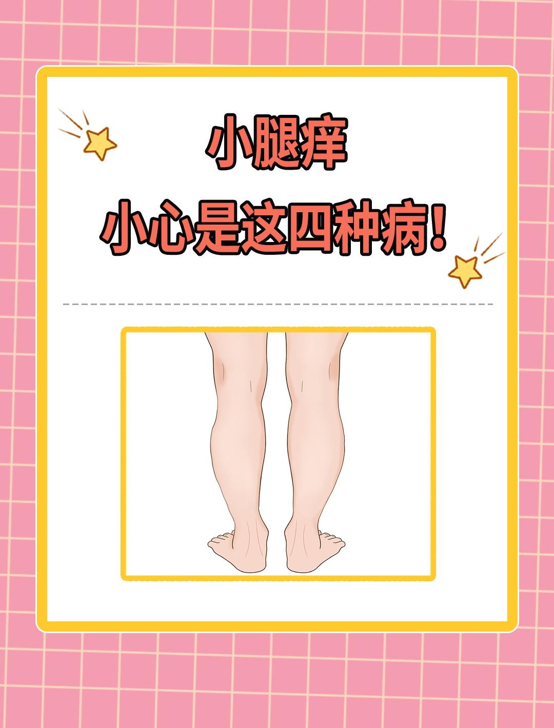 为什么腿上会痒