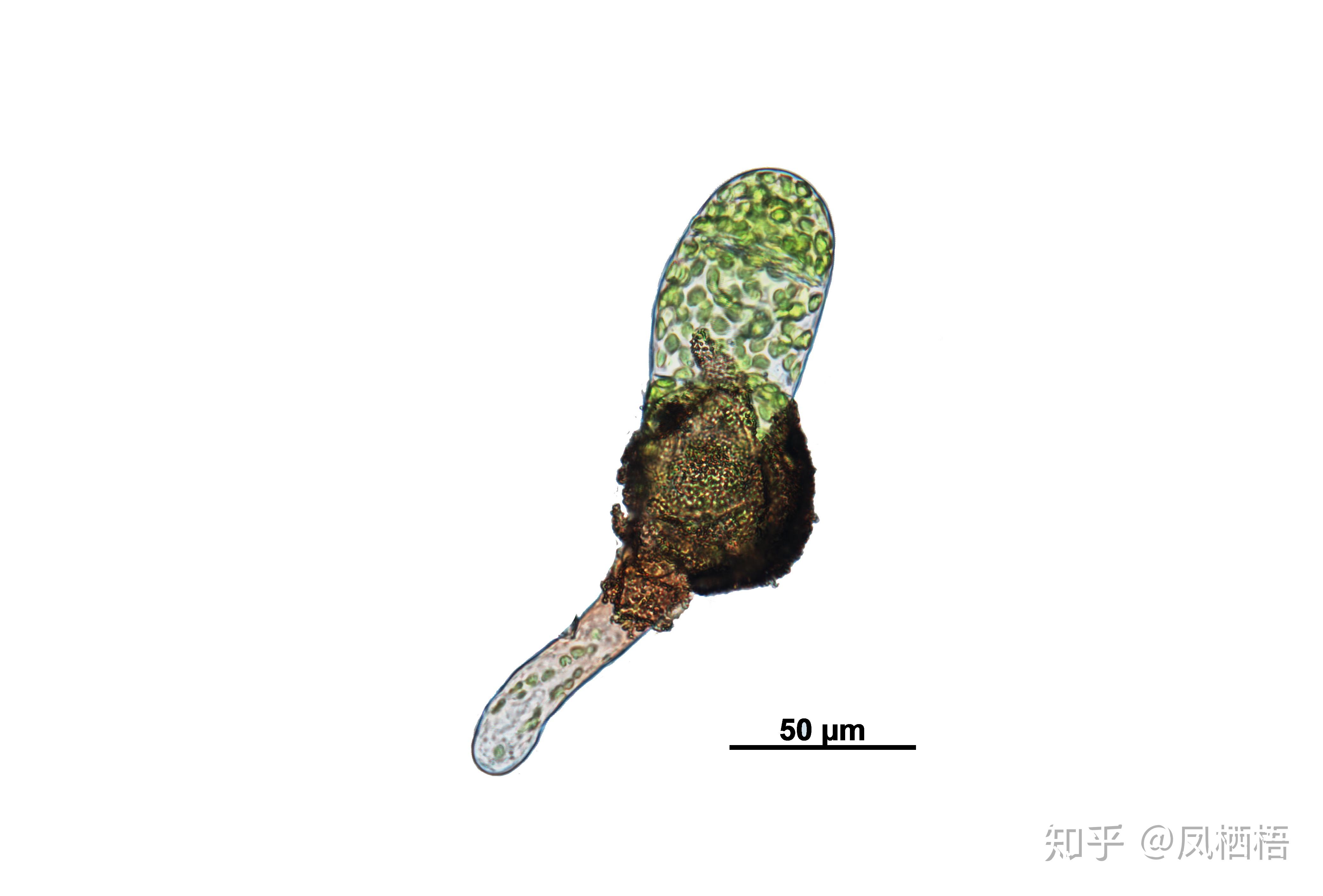 这是蕨类的孢子,为什么在十倍镜下像是一串葡萄,是多个孢子的聚合体?