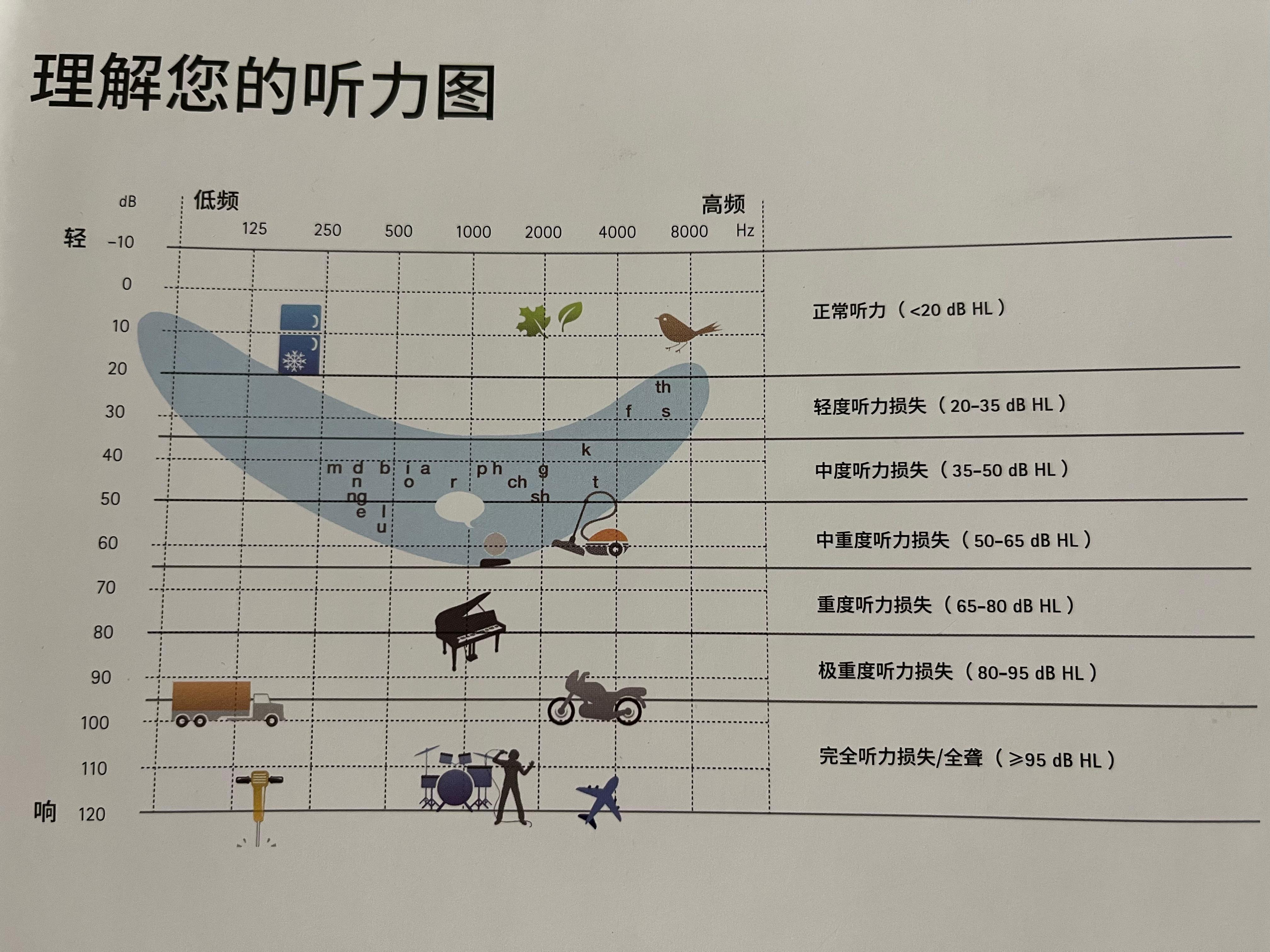 如何看懂听力测试图? - 知乎