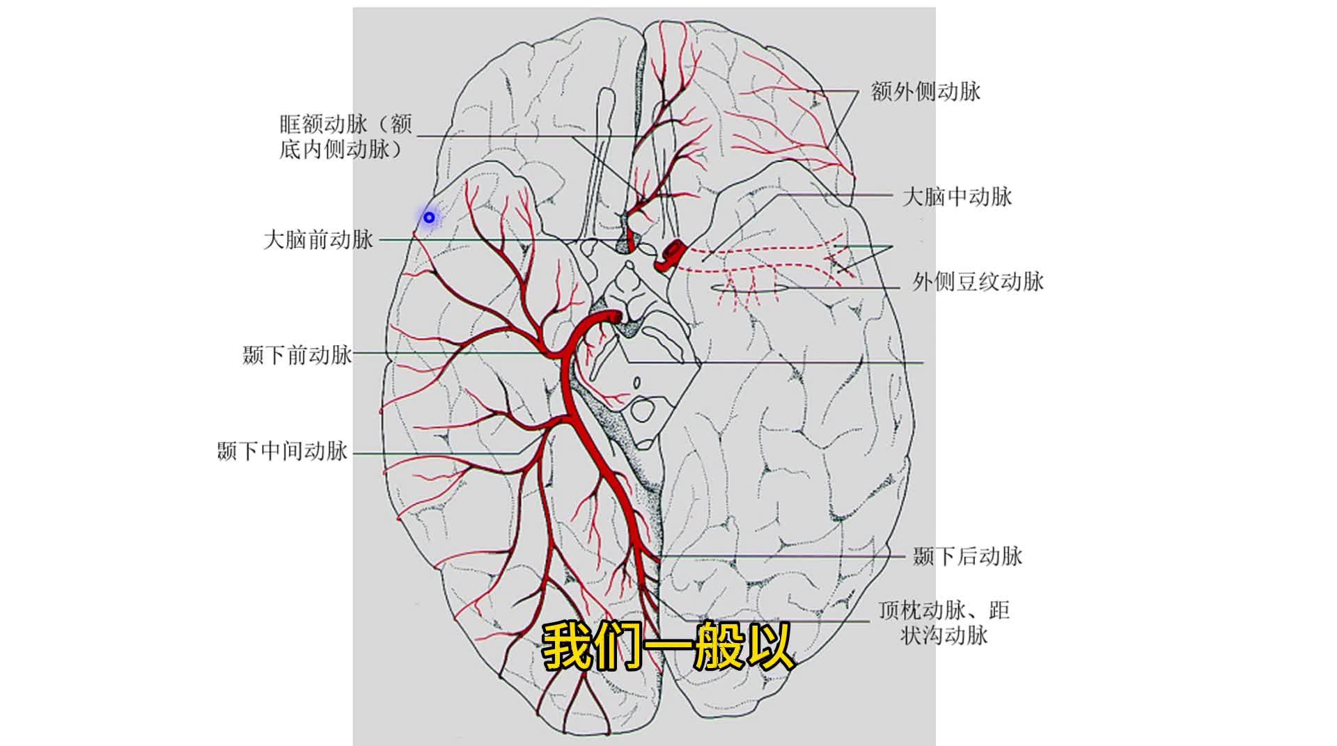 大脑后动脉TIA图片