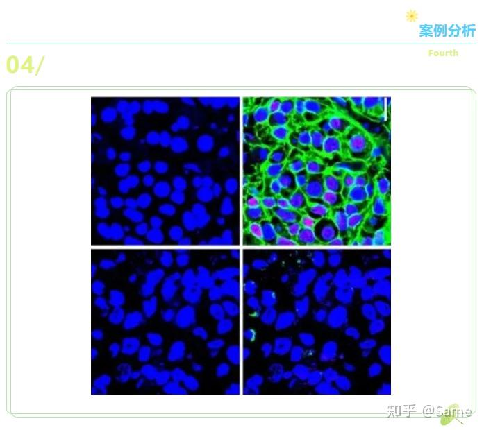 DAPI发光染的是死细胞还是活细胞？ - 知乎