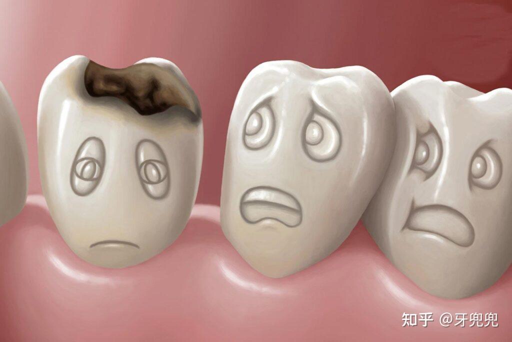 牙齿矫正堪比整容?别被骗了 - 知乎