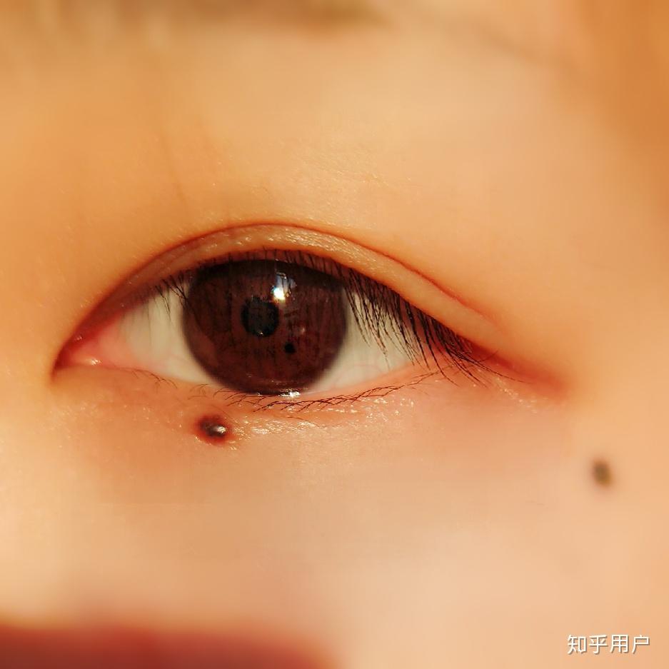 历史上的重瞳子是真实存在的吗?两个瞳仁在眼睛里是如何分布的? - 知乎