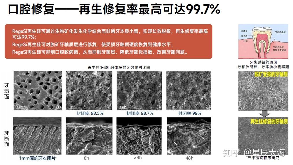 牙齿修复的秘密花园:左点再生硅牙膏,呵护每一颗敏感牙齿 - 知乎