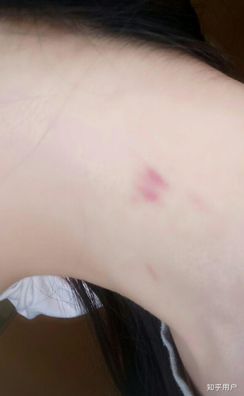 草莓(吻痕)种不出来是为什么? - 知乎