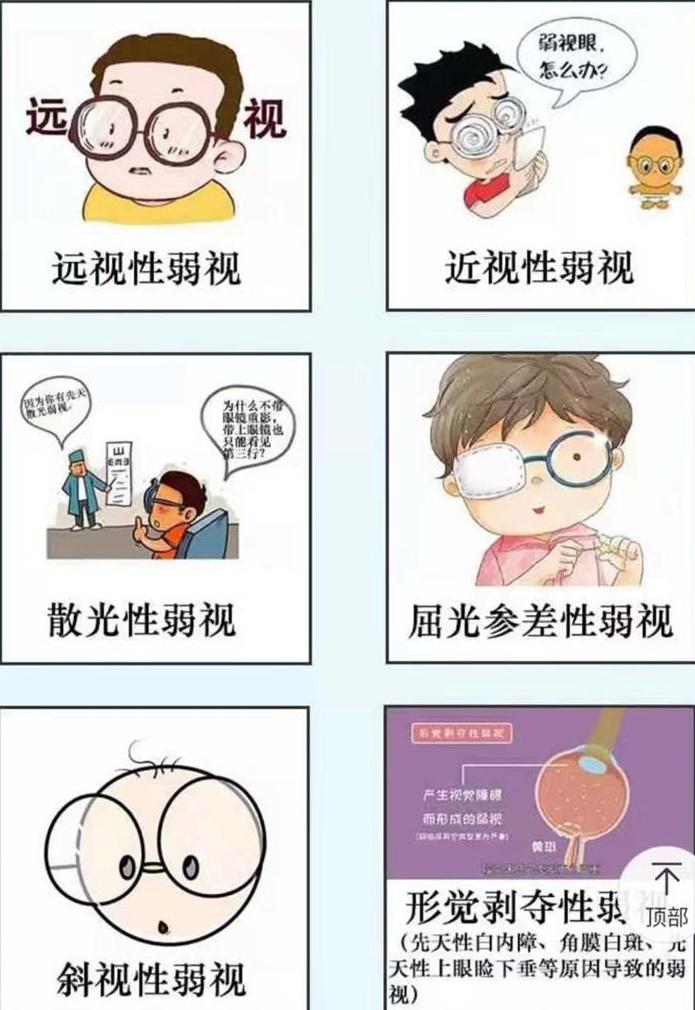 清晰美弱视小知识 ６ 弱视都有哪些分类 知乎
