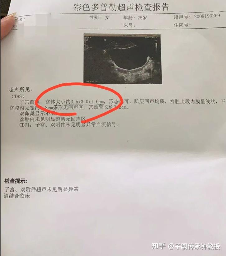 良辰美景!什么是幼稚子宫?"欢聚一堂"-第2张图片-龙吟凤网