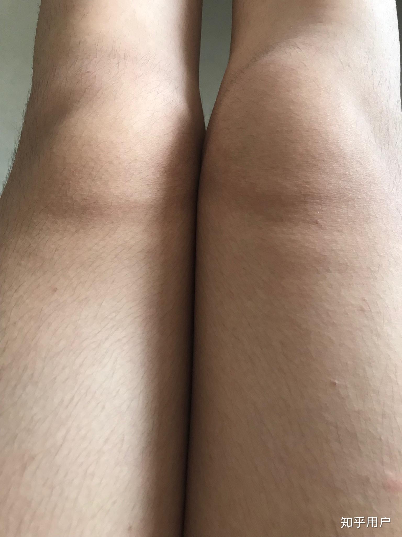 女生既有腿毛又腿粗是什么体验