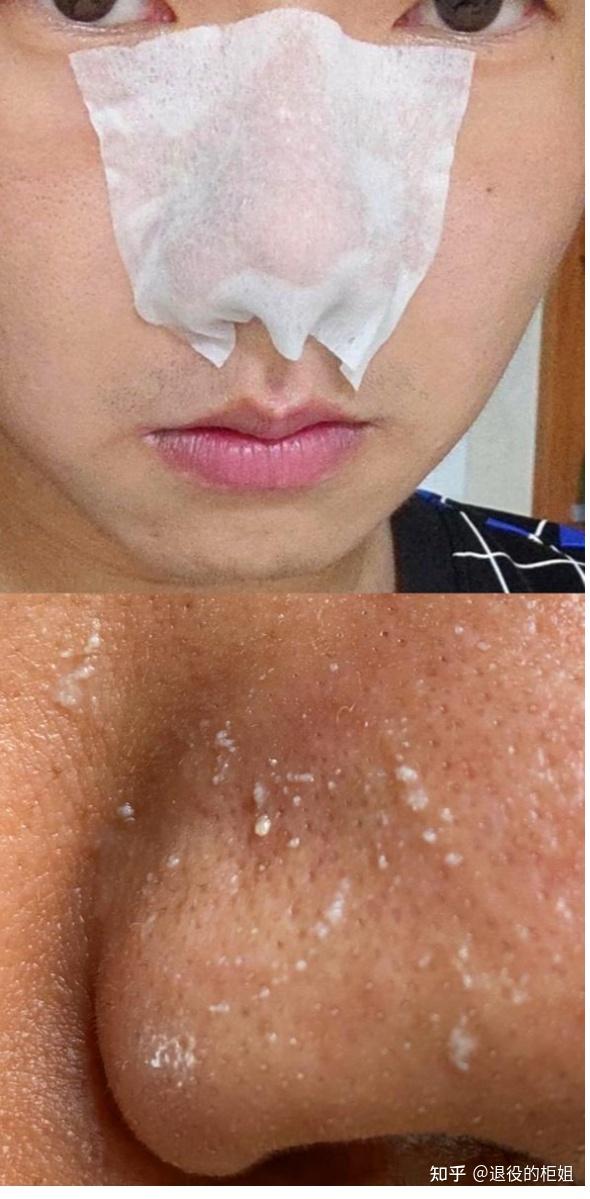 为什么我的脸看起来很脏? 该怎么修复?
