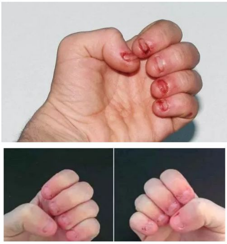 孩子老爱咬指甲应该怎么纠正? - 知乎