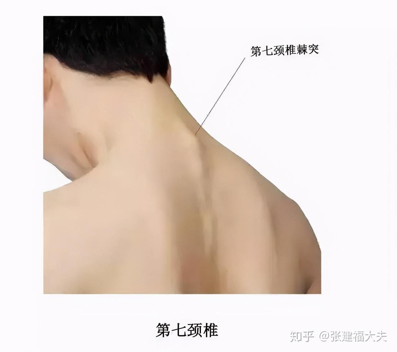 手麻是什么原因