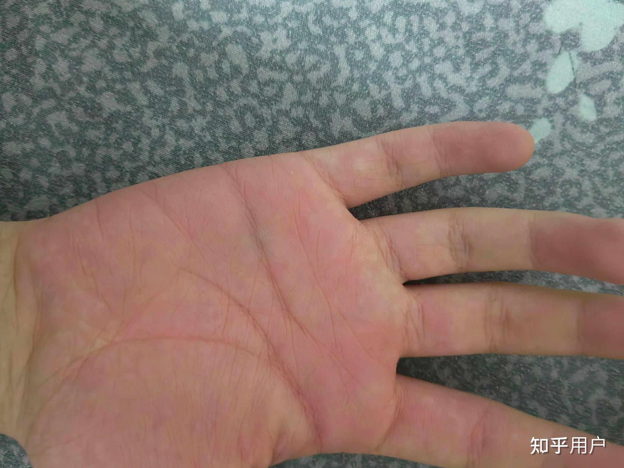 被打手心是种怎样的体验?