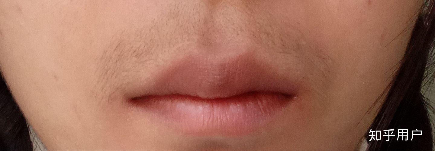 女生有唇毛可以用镊子拔么? - 知乎