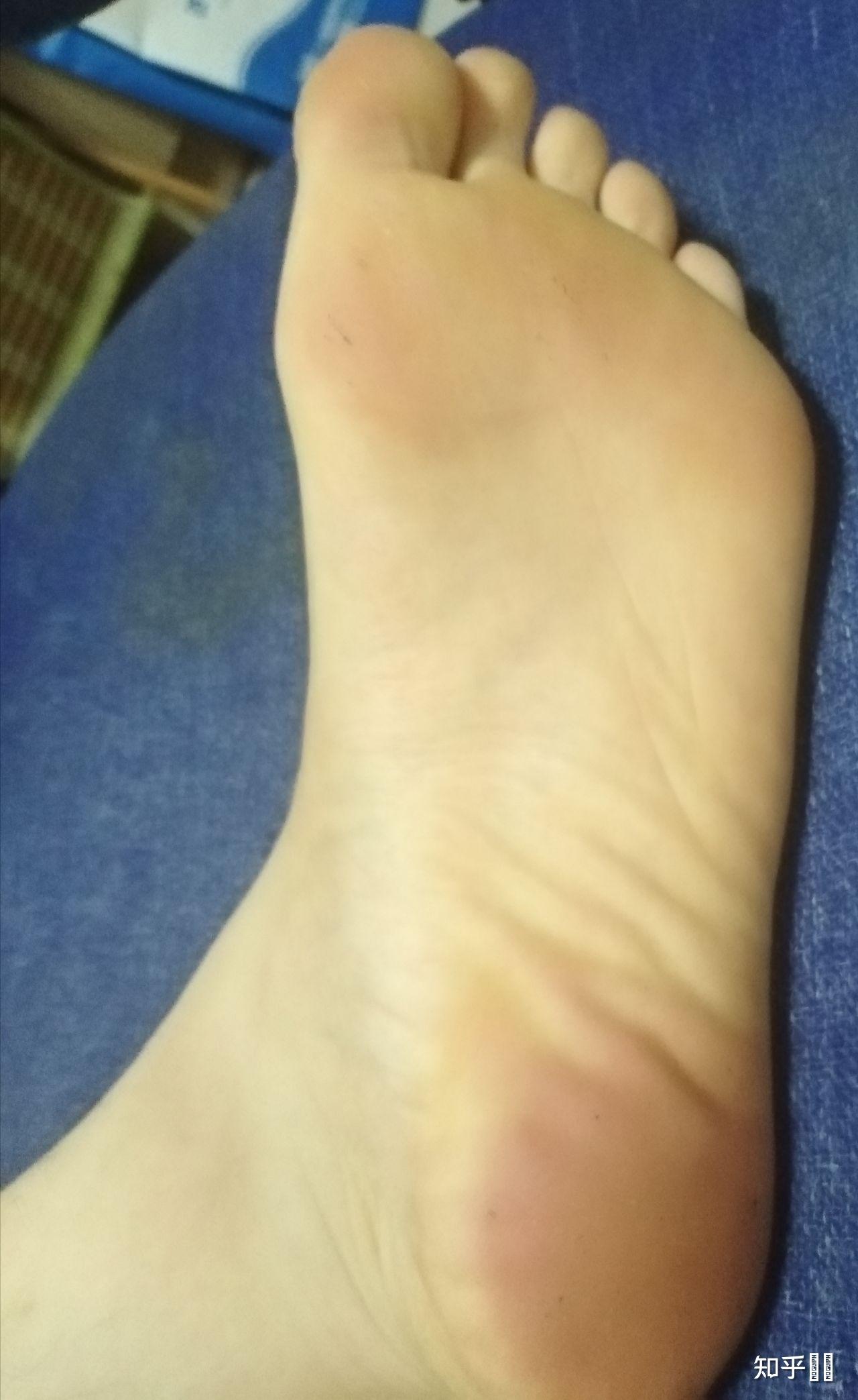 怕痒的男生会经常被女生欺负吗? - 知乎