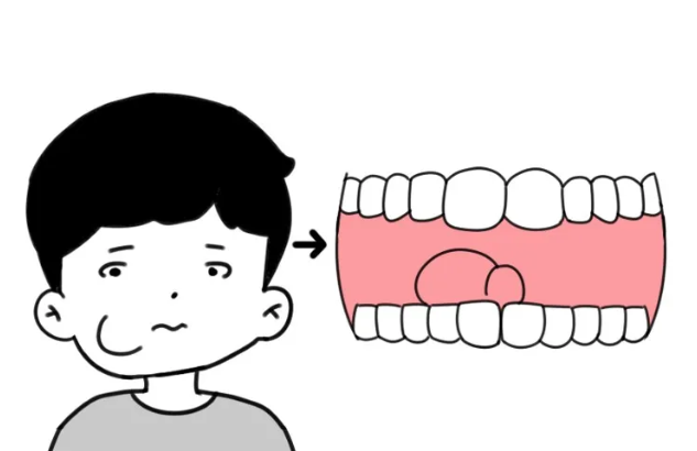 小心!长期单侧咀嚼,不仅毁牙还毁容