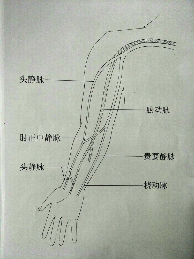 女生抽血后手臂淤青晕倒,院方回应,你生活中遇到过类似情况吗?