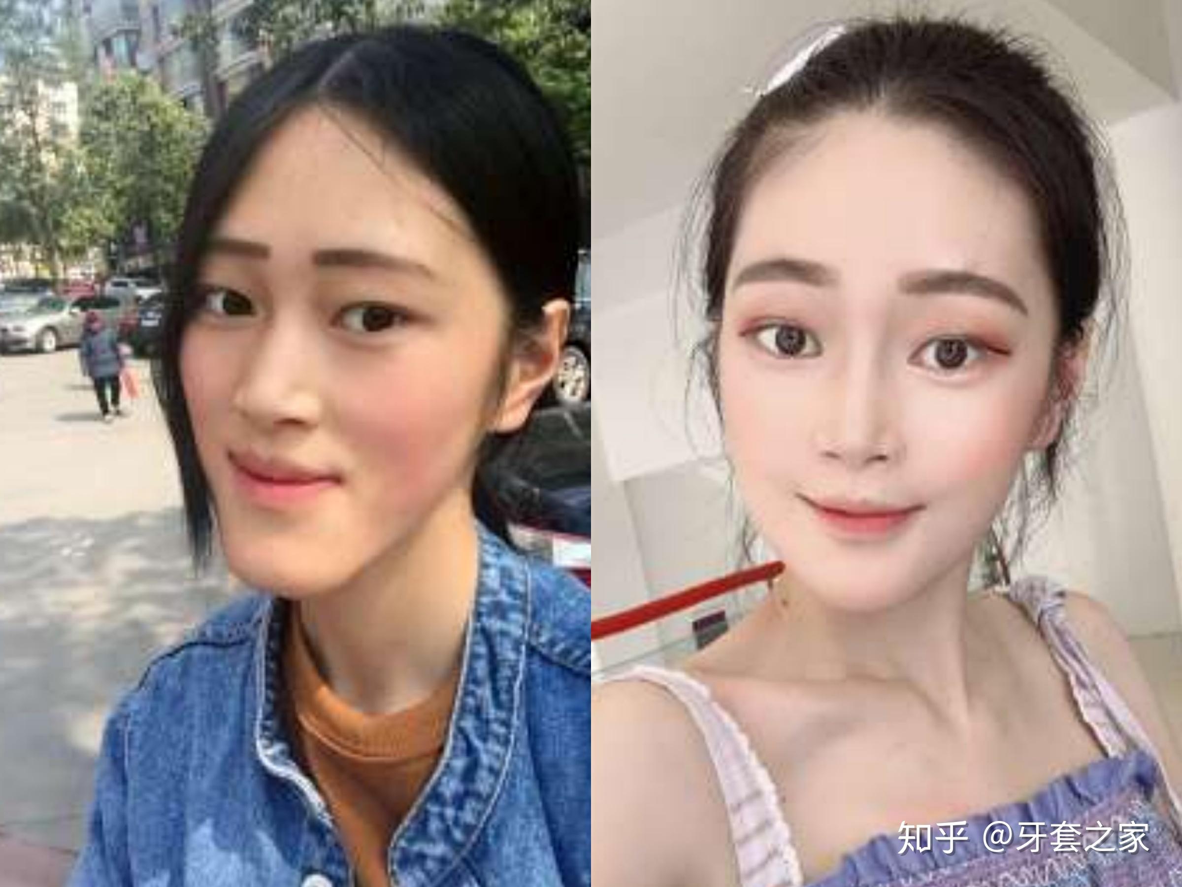 鞋拔子脸?是不是很丑? - 知乎