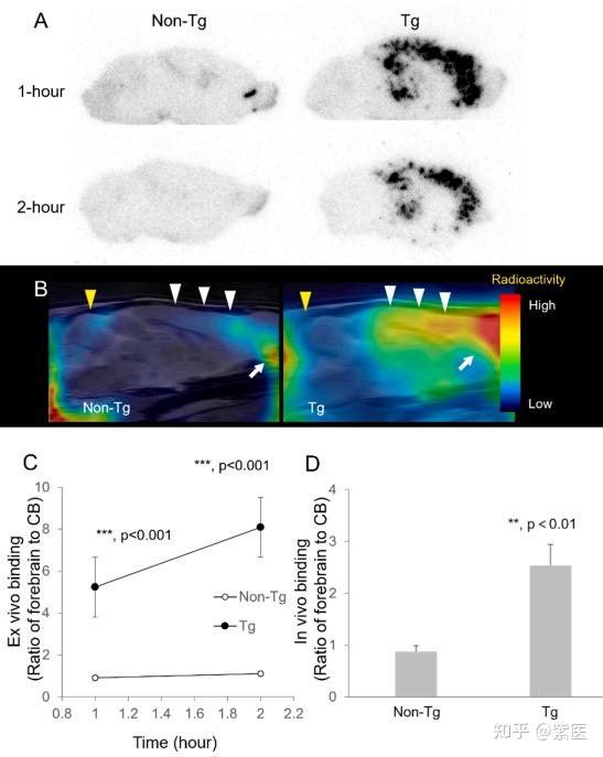PET/CT 太贵？要不试试 SPECT/CT，还是Aβ与Tau双靶点探针！ - 知乎
