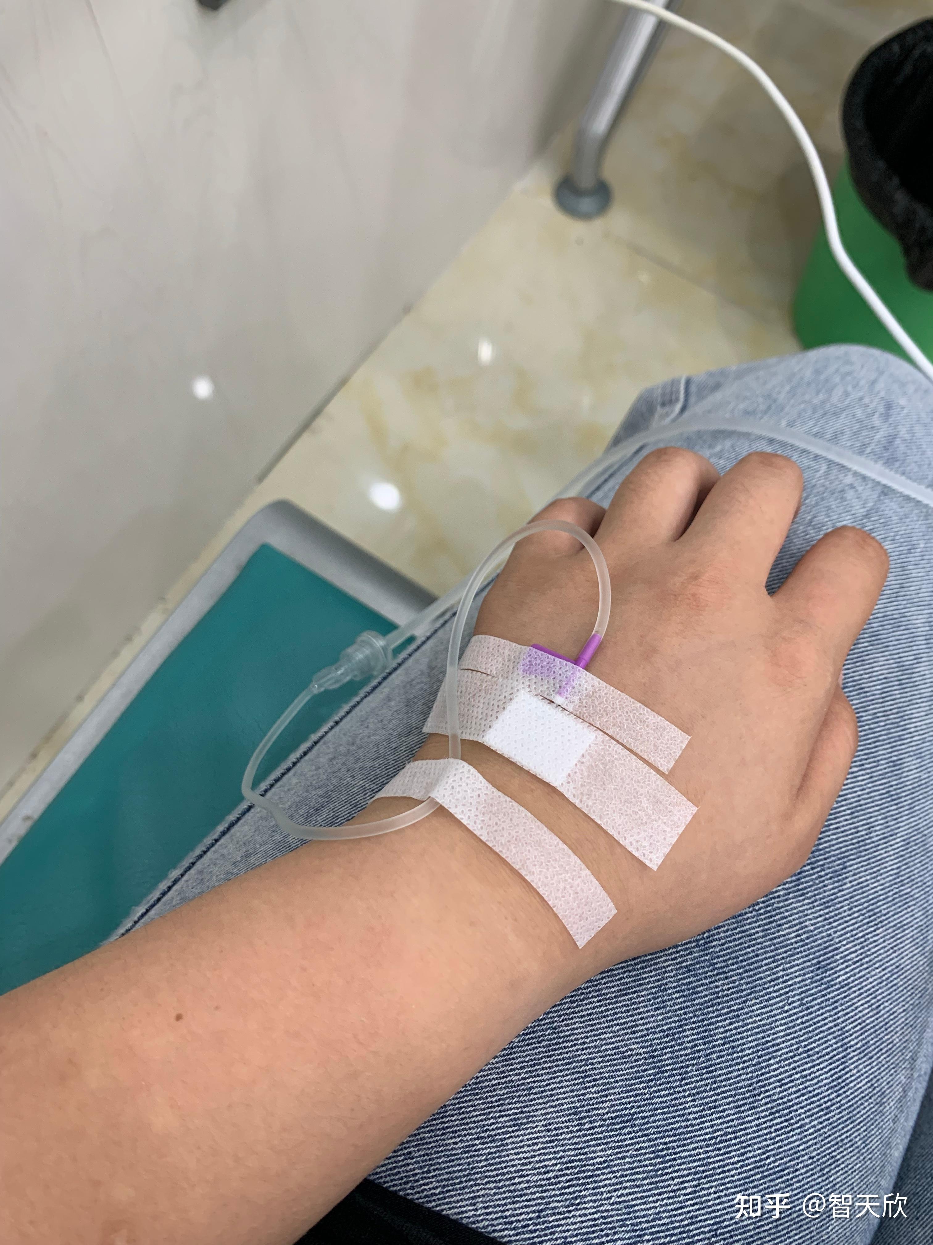 有没有输液的照片我给老师请的病假她要我发照片给她