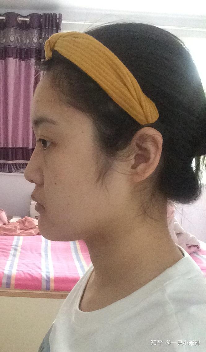 翘下巴?月亮脸?鞋拔子脸?是不是很丑? - 知乎