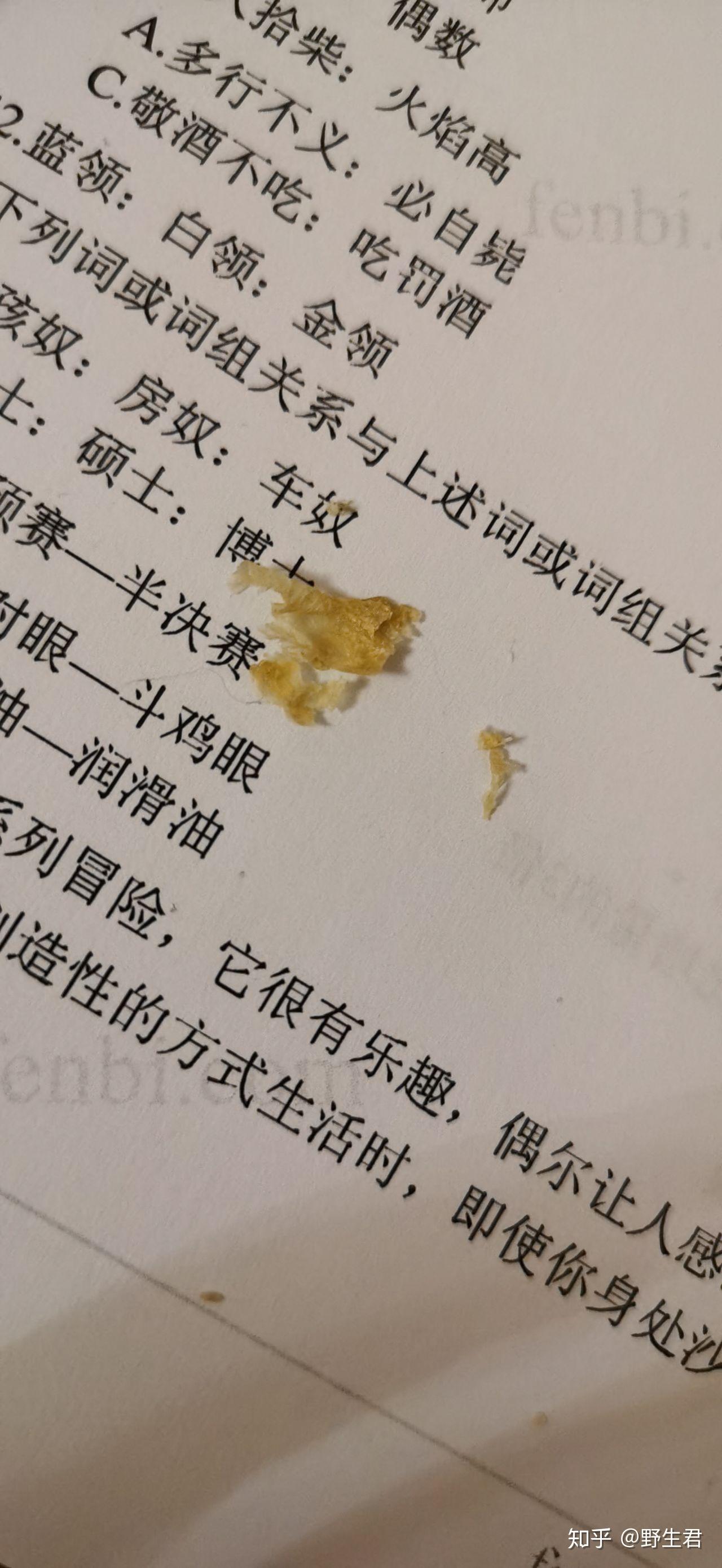 为什么我掏出来的耳屎是桶状的,就是一层薄膜粘附在耳壁上? - 知乎