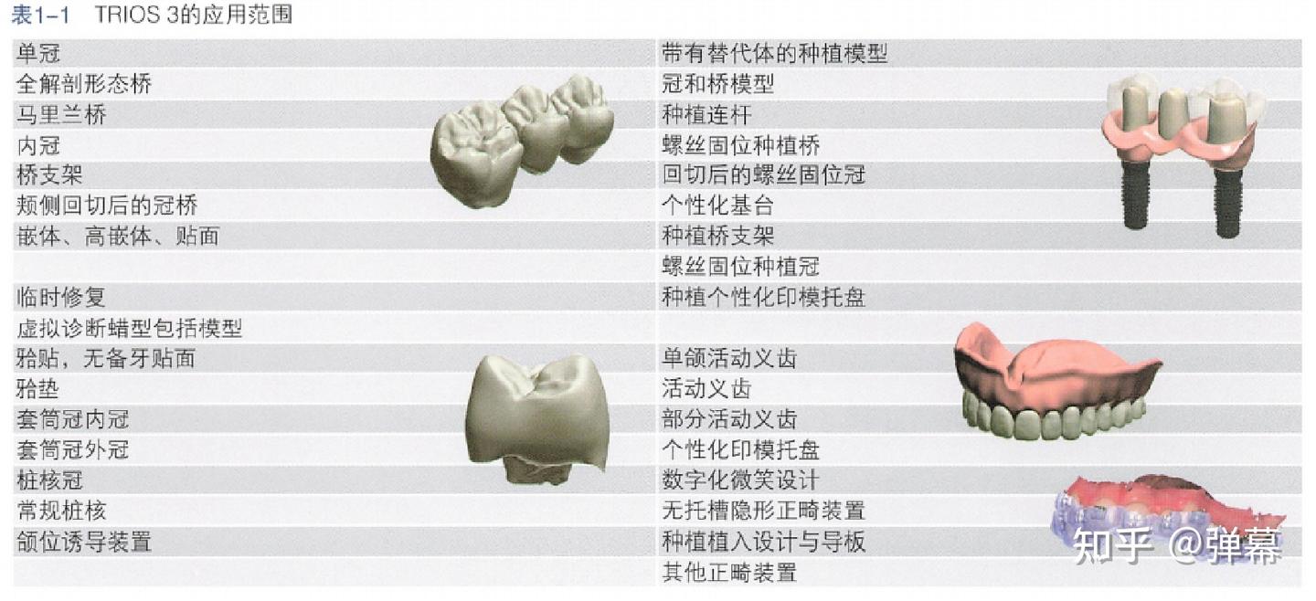 3shape口扫取模和传统取模的区别是什么？优势是什么？ - 知乎