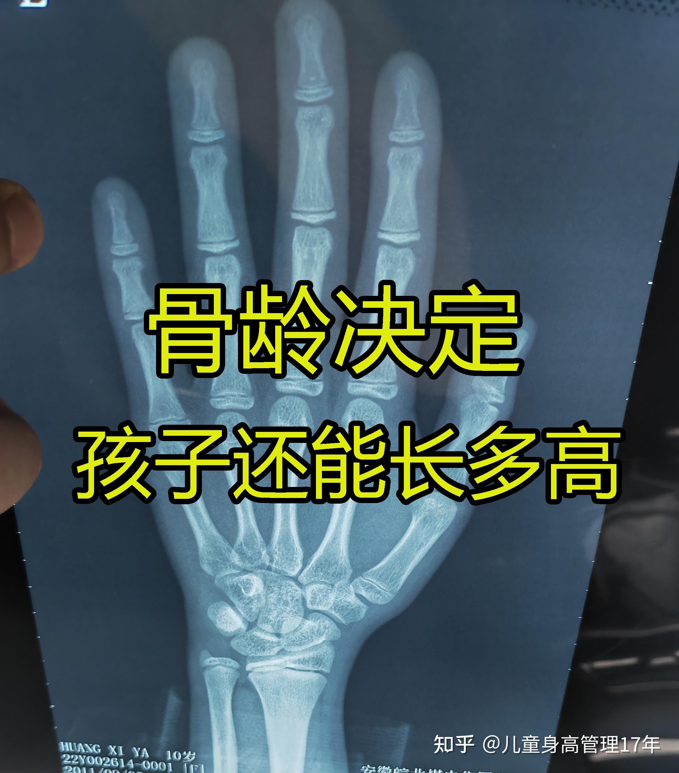 女孩来了大姨妈还能长高多少厘米