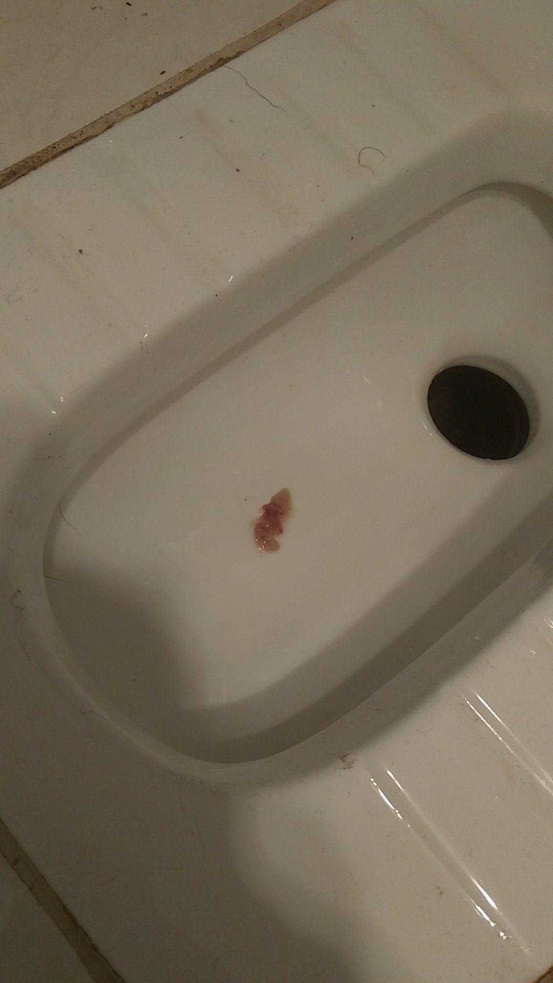 喉咙痛了两天今早嗑出来的痰有血正不正常ππ吓死我了