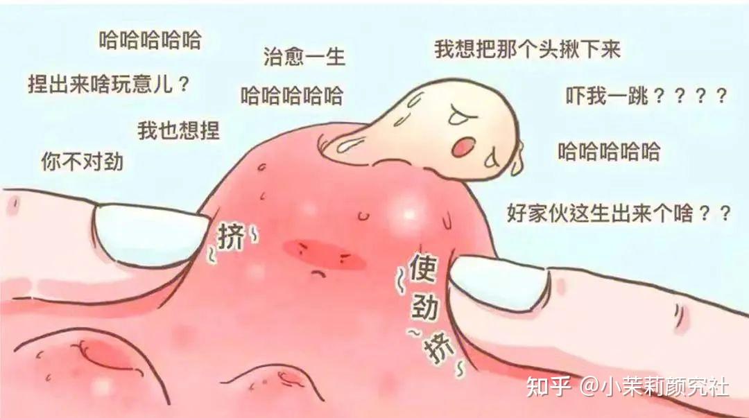 别再挤痘啦!挤出来的分泌物是什么,你知道吗... - 知乎