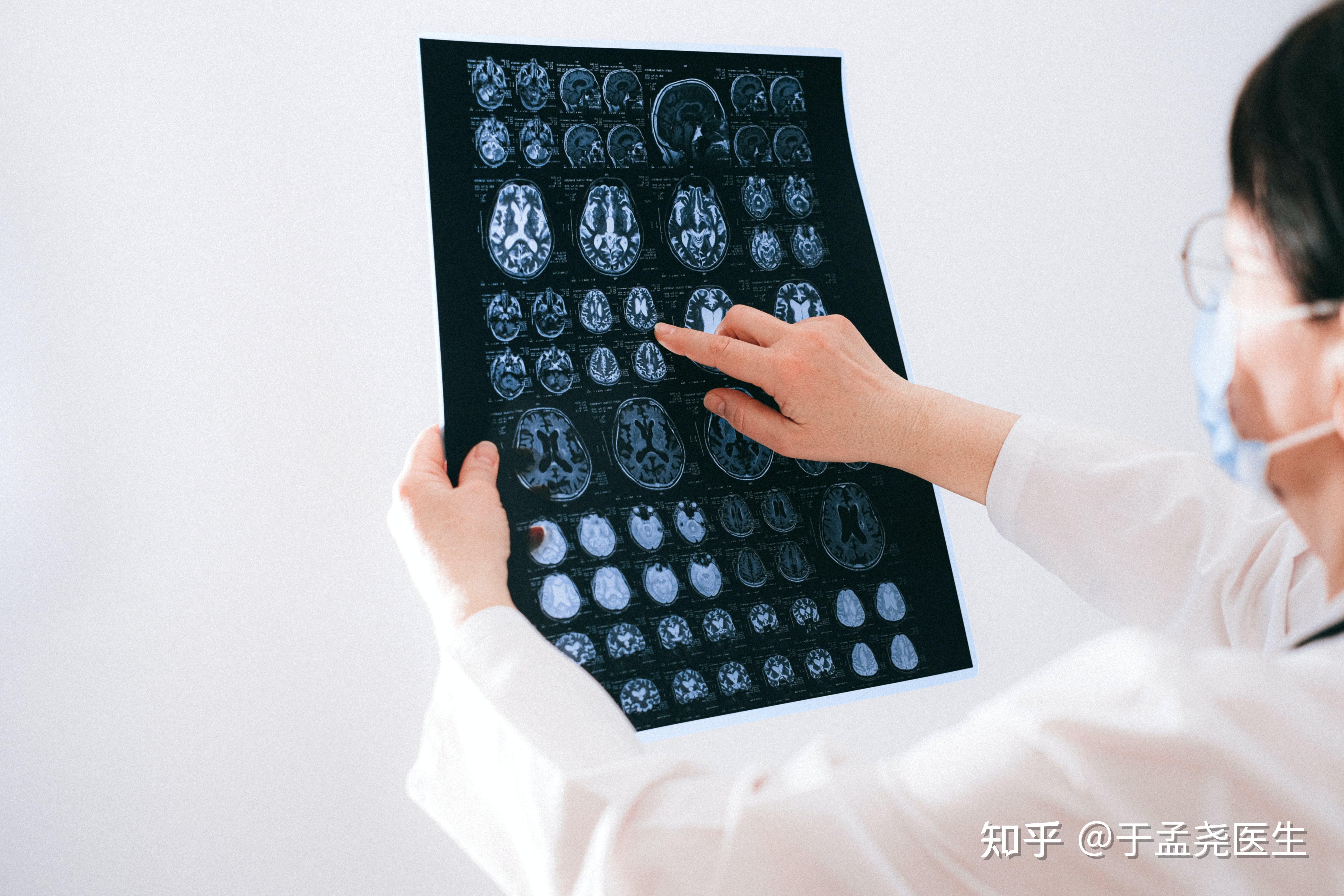 精神病人能治疗吗知乎(精神病人可以治愈吗?)