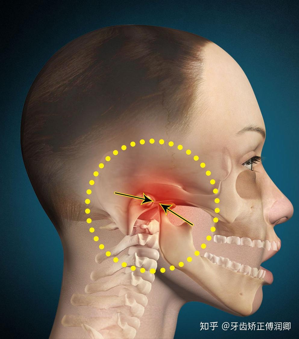 吃东西嘴巴张的太大了,然后我感觉我现在挂钩好像有问题,就是一张大嘴