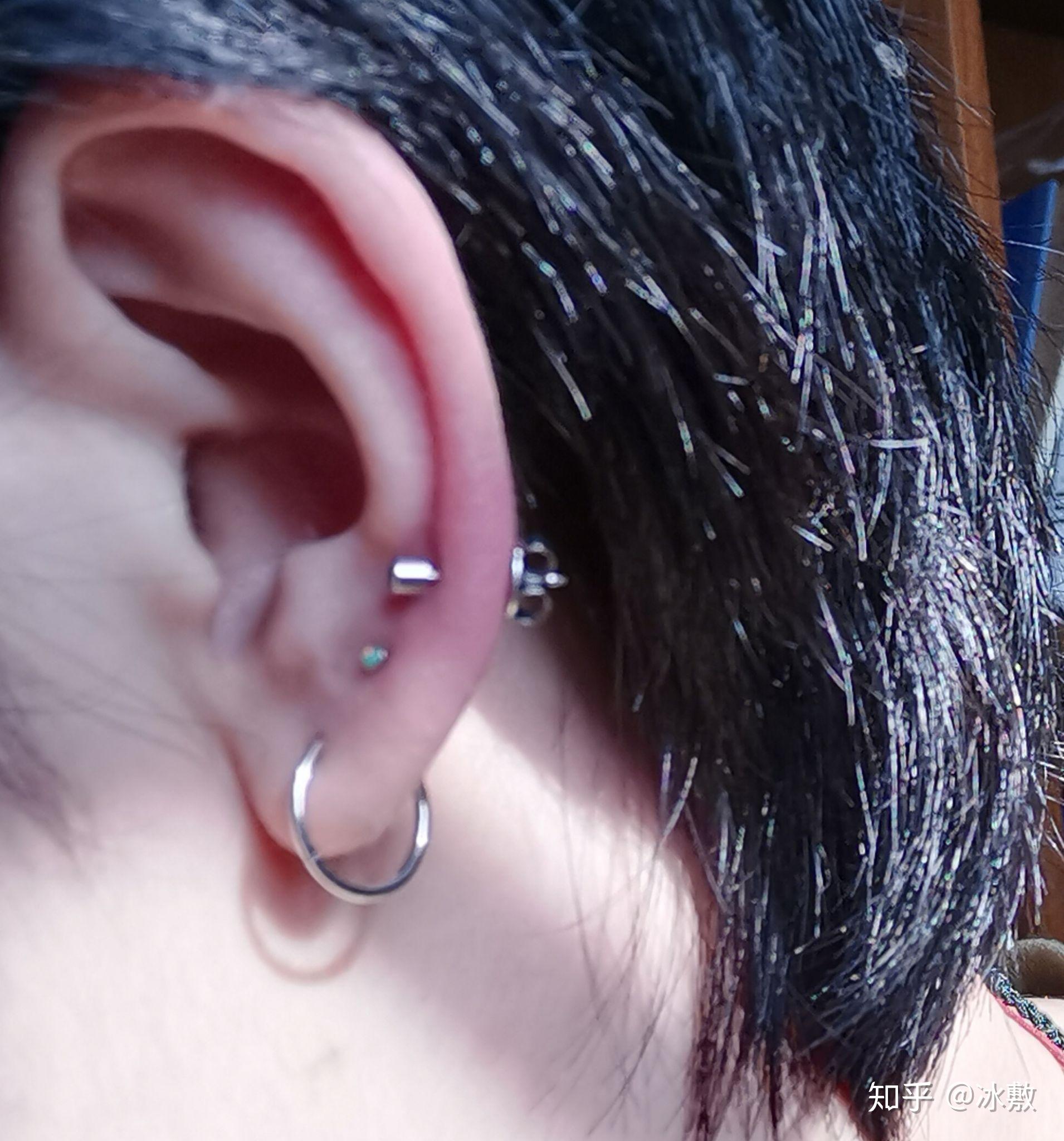 厚耳垂打耳洞真的很可怕吗