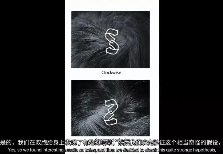 头顶的发旋的位置为何有左有右，据说发旋在右边的的人都比较聪明？ - 知乎