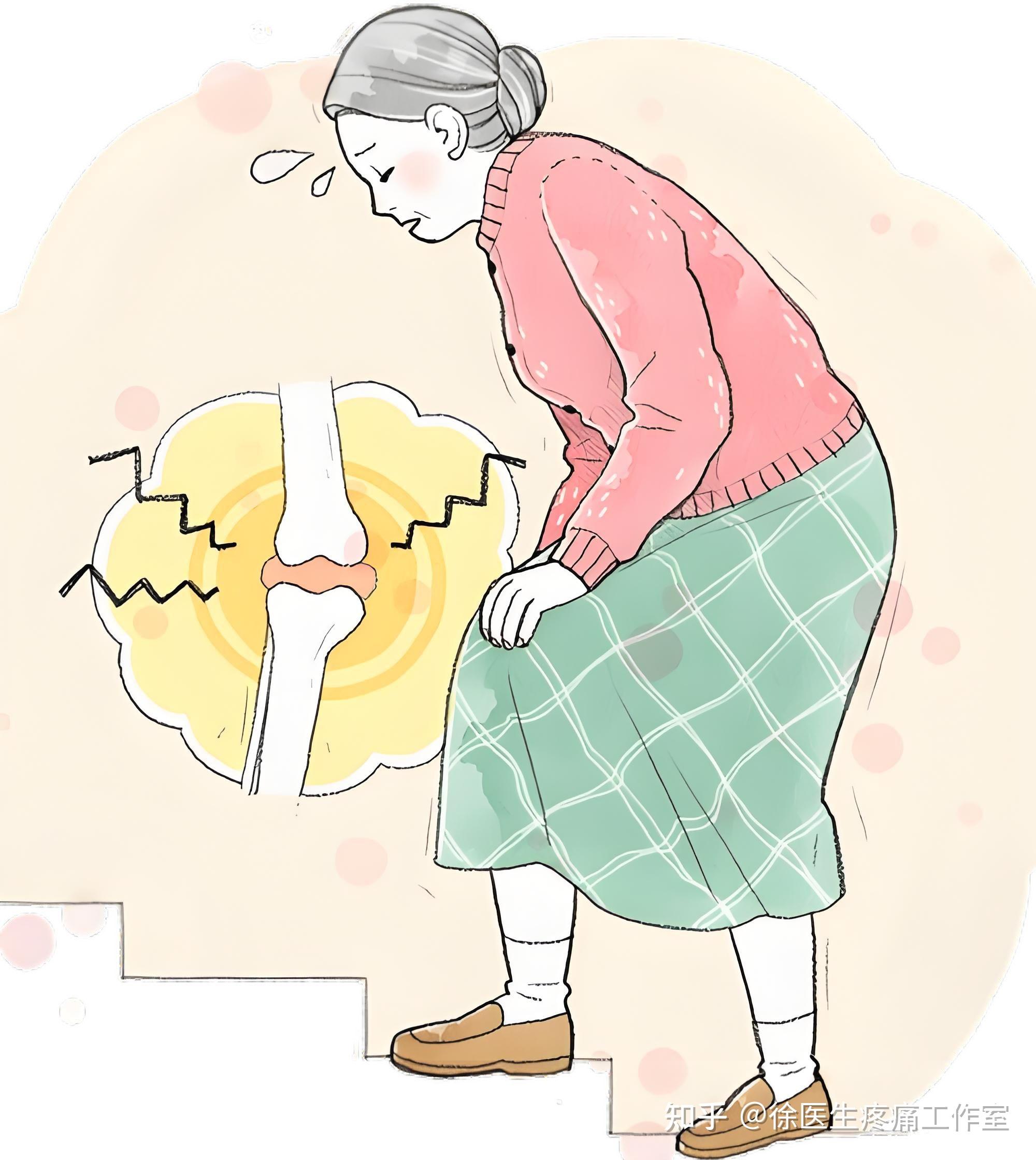 运动受伤别瞎敷!冰敷用错,越敷越伤,这些误区你踩了吗? - 知乎