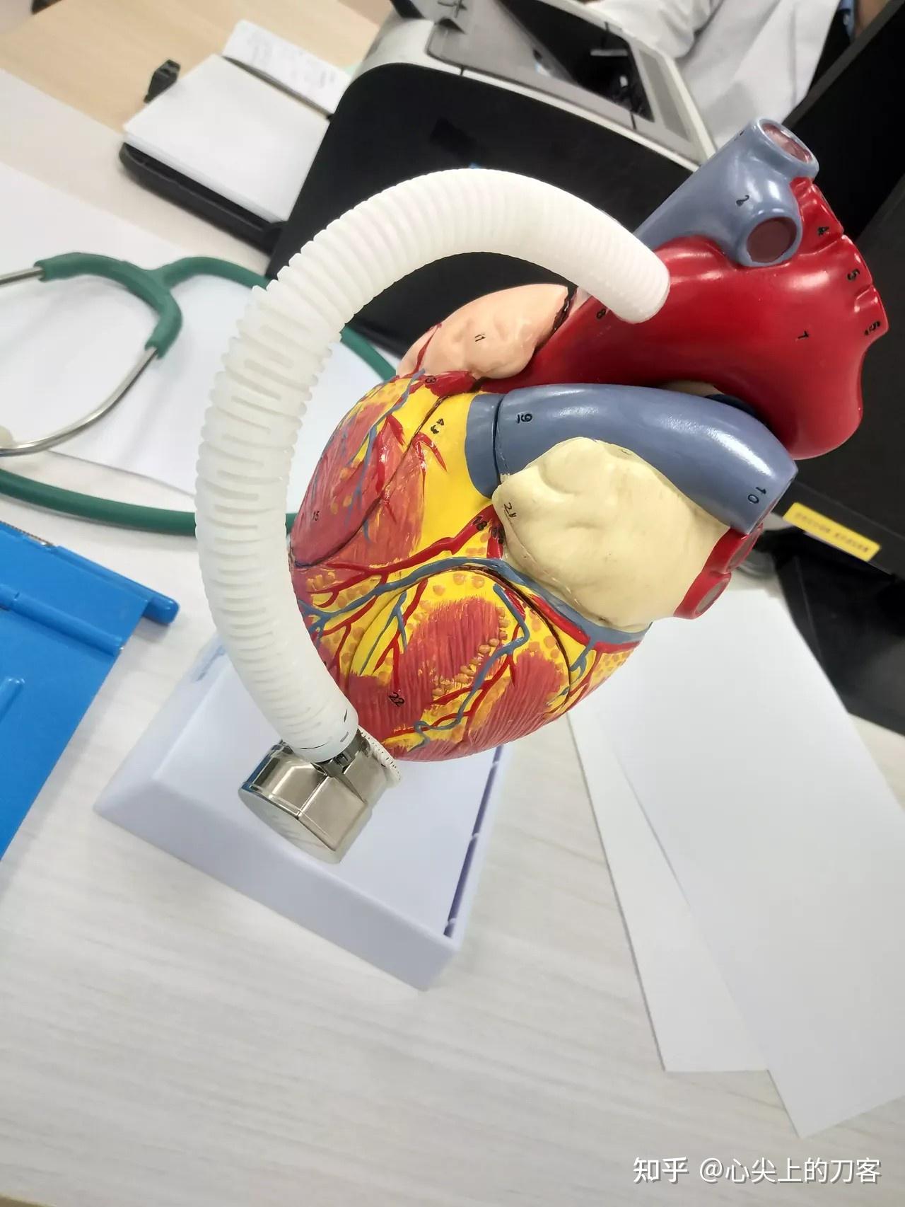 全球最小全磁悬浮人工心脏植入在无锡完成这种全球最小全磁悬浮人工