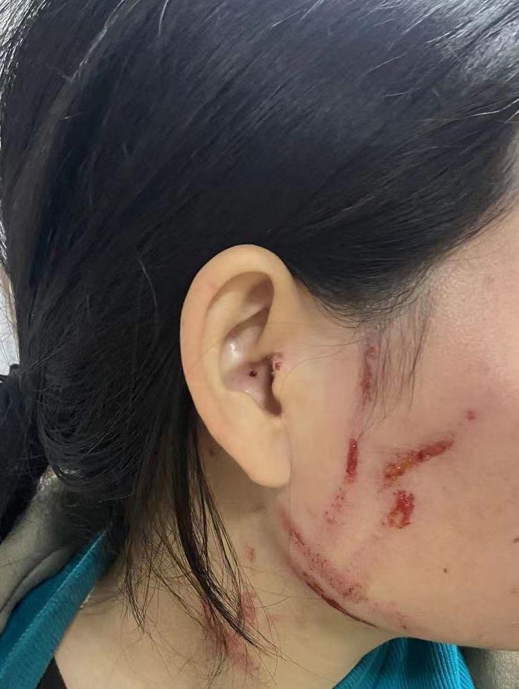 因民事纠纷打了别人两巴掌会不会被拘留? - 知乎