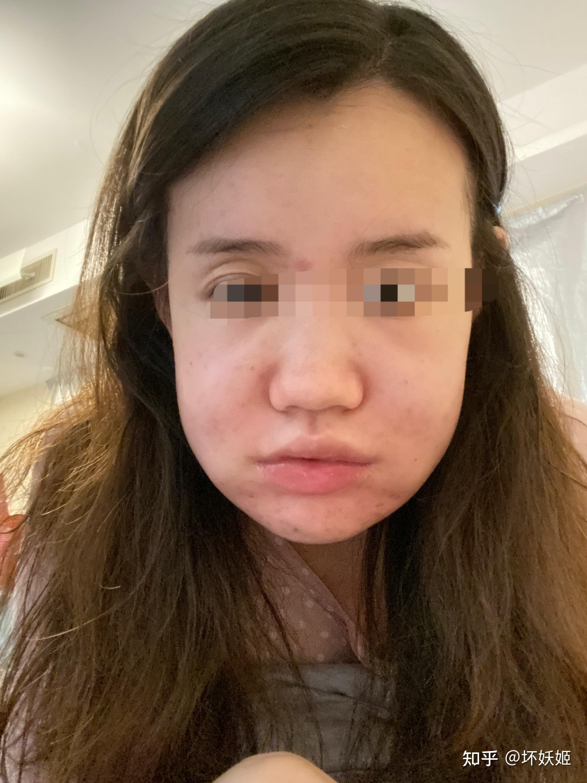 鞋拔子脸?是不是很丑?