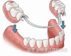 跟你说！口腔修复科不是补牙的！那到底是干啥的呢？ - 知乎