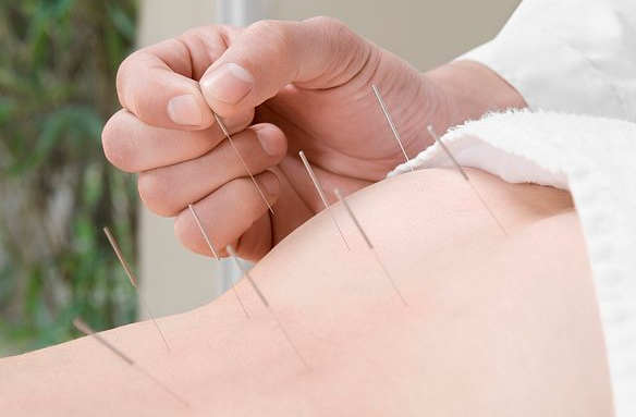 中医针灸十大急救穴——猝死急救选内关