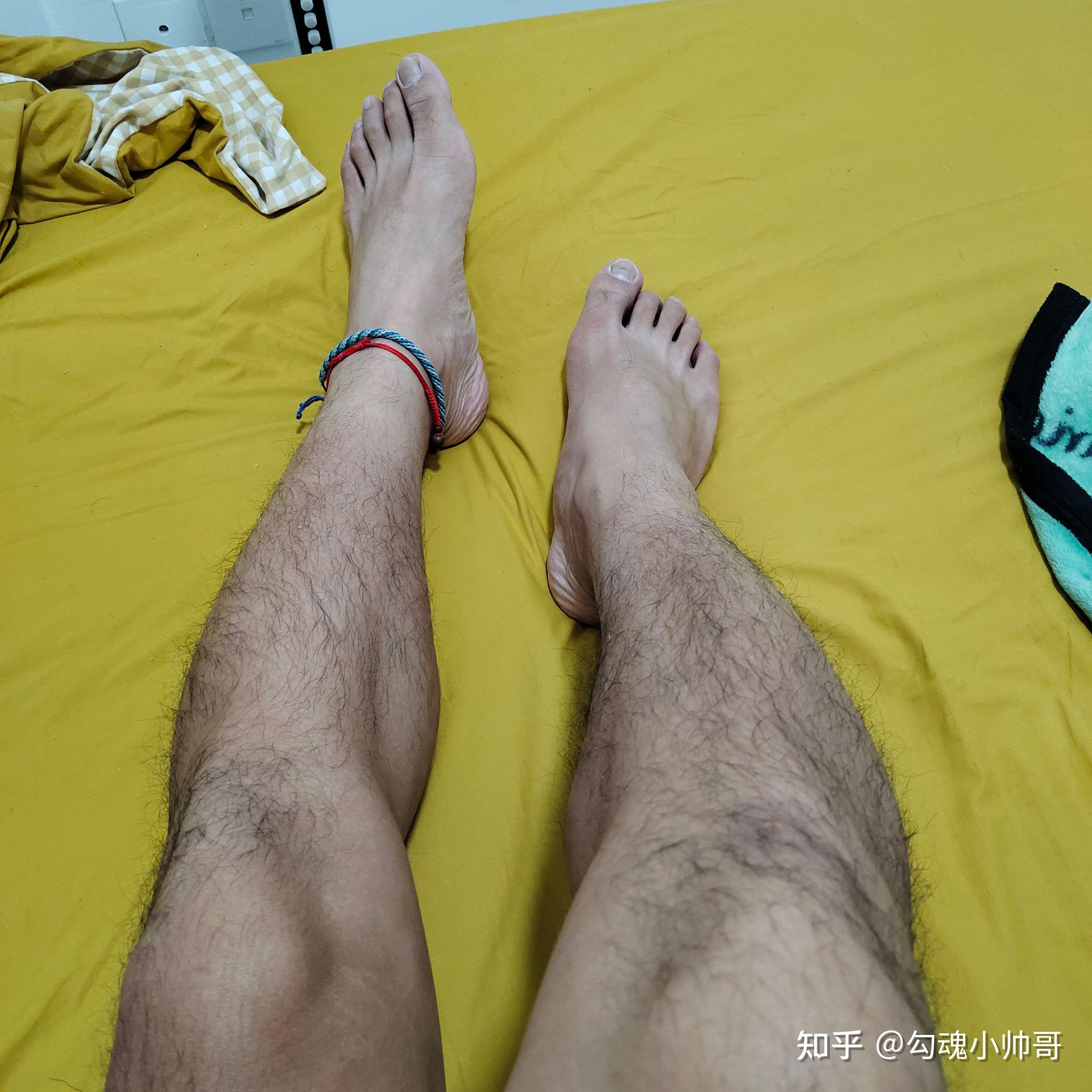 男生腿毛浓密怎么办?